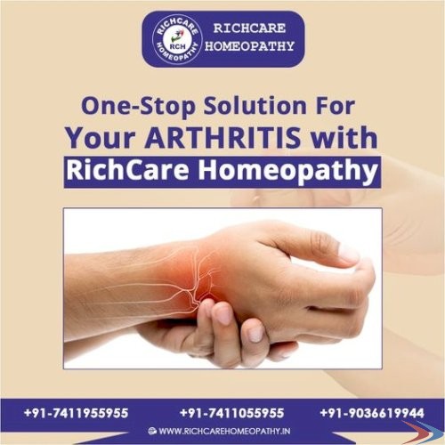 Rheumatoid Arthritis Treatment | Treatment for Arthritis in Knees